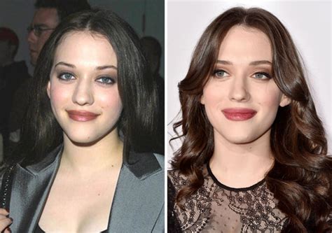 Kat Dennings Plastic Surgery Photos [Before & After]